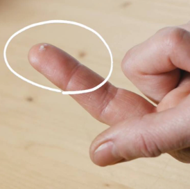 yun probiotics προβιοτικά ακμή ελλάδα elpon atopia microcapsulation